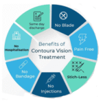 Benefits of Choosing Contoura Eye Surgery for Vision Correction