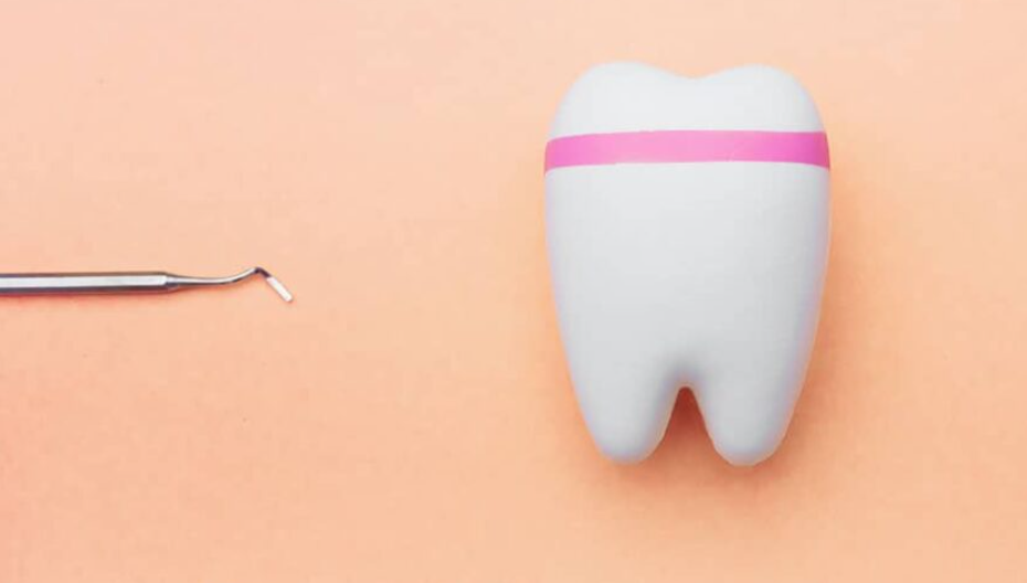 How Private Dentists Evaluate Tooth Enamel Erosion Patterns to Identify Hidden Dietary and Lifestyle Risk Factors